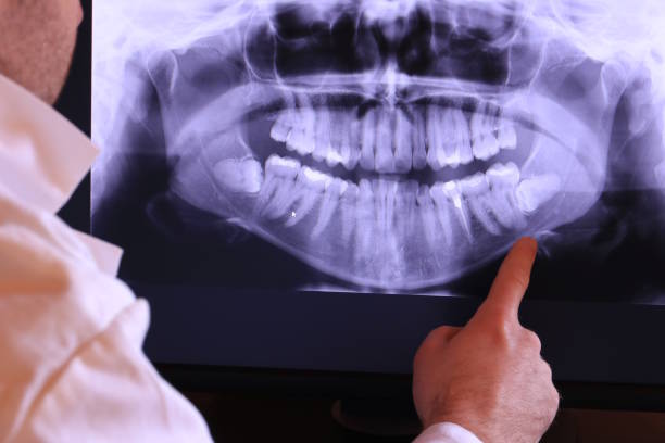 Best Emergency Tooth Extraction  in Thomas, OK
