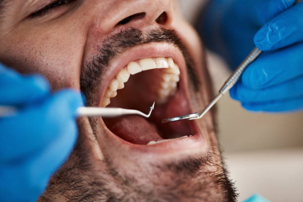 Best Knocked-Out Tooth Emergency  in Thomas, OK